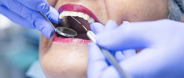 Best Emergency Denture Repair in Union Park, FL